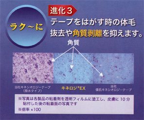 NITREAT キネシオロジーテープ キネロジEX 50mm x31.5m Amazon | ニトムズ ニトリート キネロジEX 筋肉保護テープ 多巻